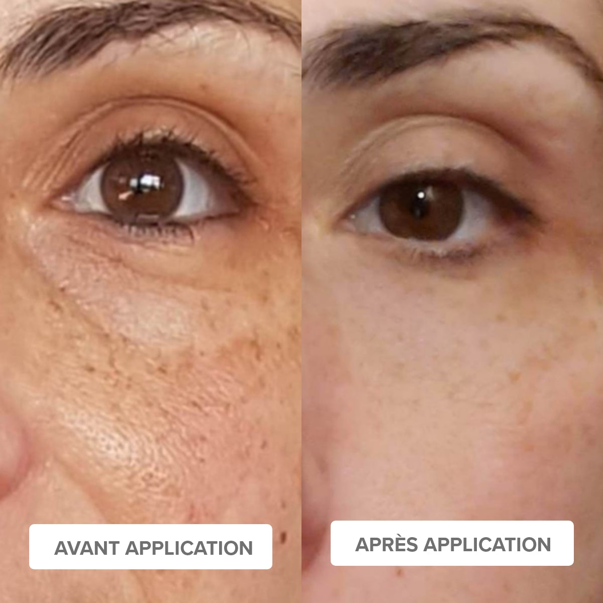 ROUTINE ANTI-TACHES - Eclaircissante & Unifiante